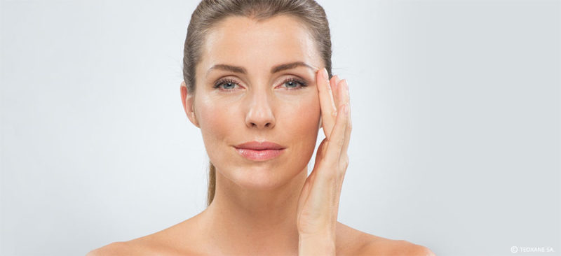 faltenunterspritzung_mainz Frau nach einer intensiven Faltenunterspritzung